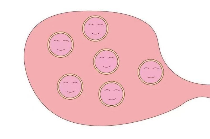 试管促排后,取卵少的“症结所在”,如何化解?
